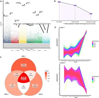 Integrated WGCNA and PPI Network to Screen Hub Genes Signatures for Infantile Hemangioma